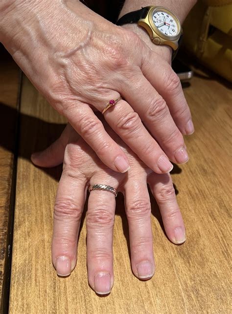 why is amy wilson cameron not wearing her wedding ring