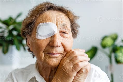 Elderly use eye shield covering after cataract surgery. 16780360 Stock
