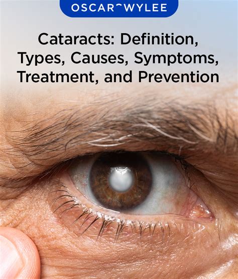 cataracts definition types  symptoms treatment  prevention