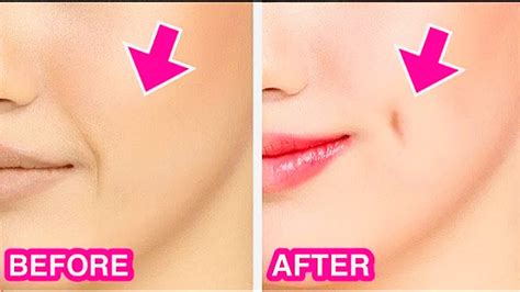 5mins Dimples Exercise! Simple Facial Exercise to get Dimples Without ...