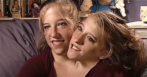 Conjoined Twins Abby and Brittany Now | 2 Miracles Sharing 1 Body