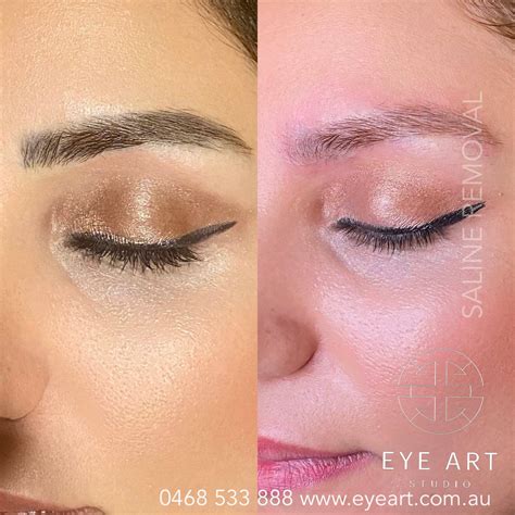 tattoo removal for eyebrows 10