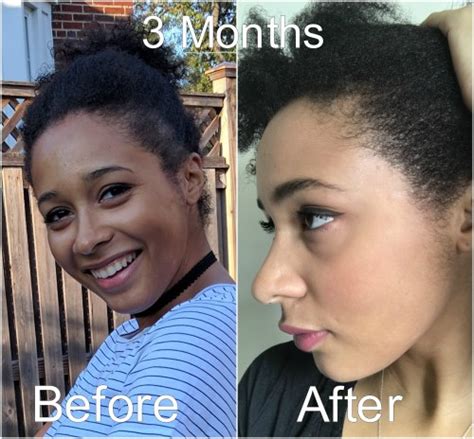 10+ Black Castor Oil Results | Fashion Style