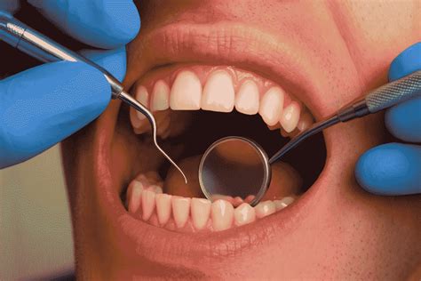 Diş Taşı Nedir? Diş Taşı Ağız Kokusu Yapar mı? - Kadıköy …
