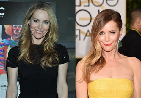 Leslie Mann Plastic Surgery Before And After Photos