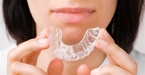 clear teeth aligners magnolia dental