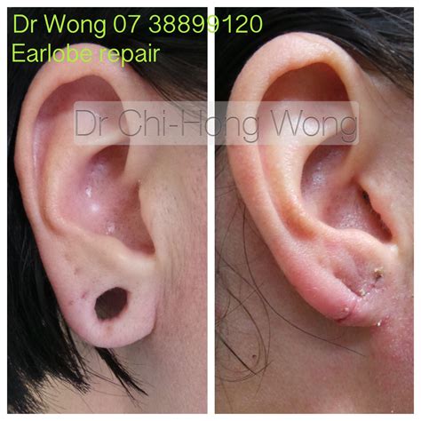 Repairing Stretched Earring Holes