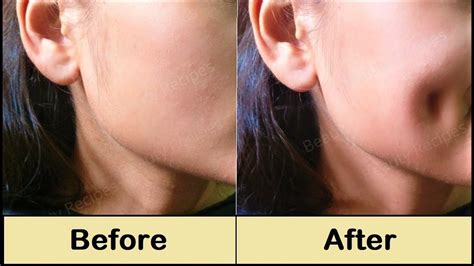 How To Get Dimples Fast & Naturally - Simple Facial Exercise to get ...