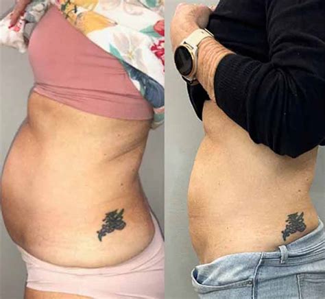 Before and After Photos of Clients in Northridge, CA
