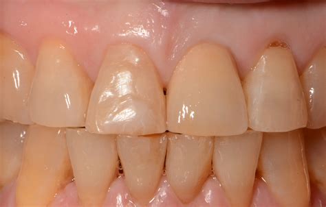 spirit dental insurance 2