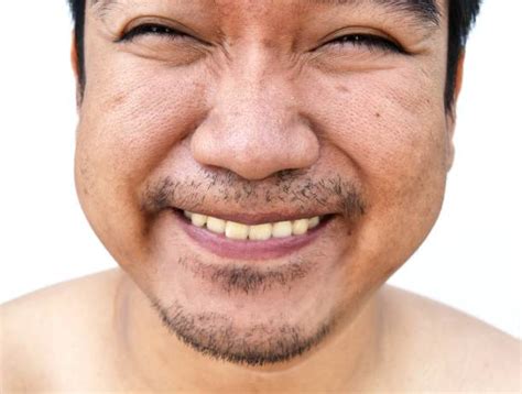 oily face man stock  pictures royalty  images istock