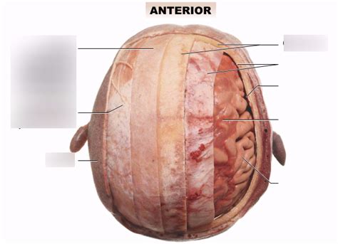 layers of the skull Diagram | Quizlet