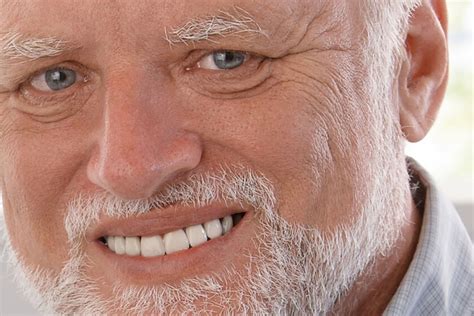 What Happened To 'Harold', The Face Behind The Popular Meme Of The Man