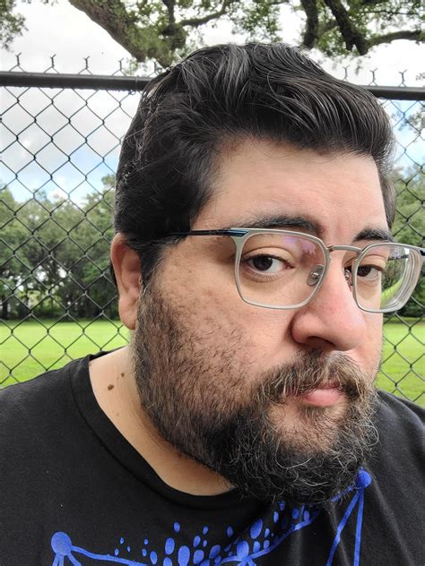 Hair loss permanent or temporary? Does my hair look ok? : r/malehairadvice