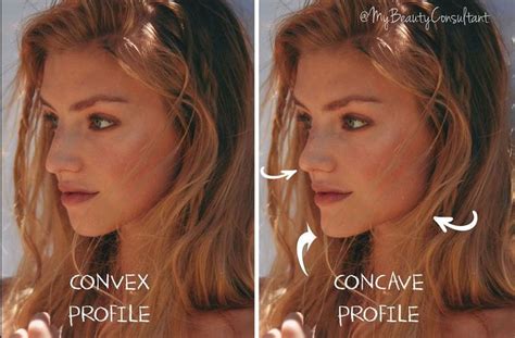 discover  difference convex  concave facial profile