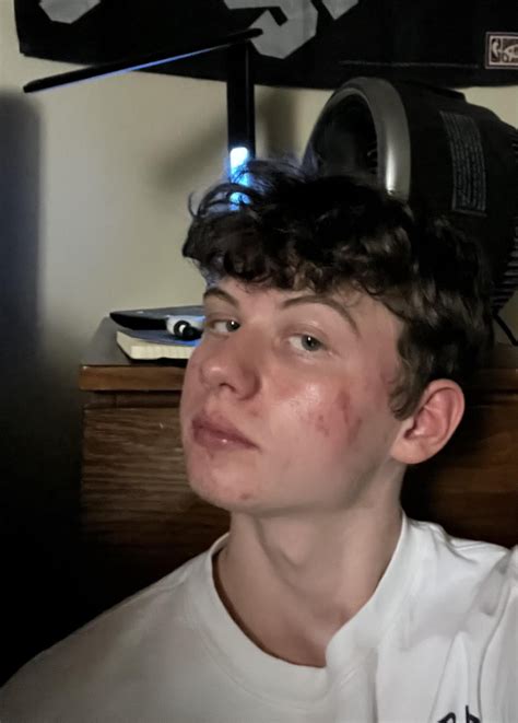 Shiny/oily/greasy skin fix? More info in body : r/Accutane