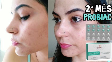 Exímia Probiac Antes E Depois