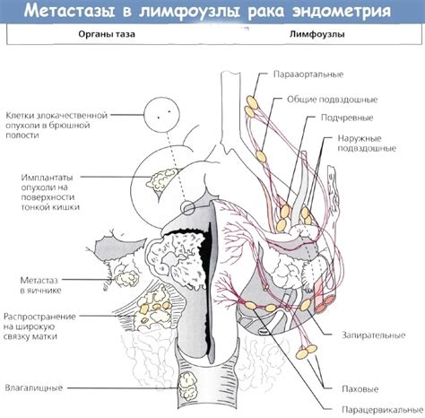 Заболевания тазовых лимфатических узлов: симптомы, лечение, осложнения ...