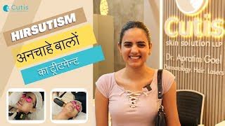 Hirsutism - Causes Symptoms and Treatment | Rashmeet Ka... | Doovi
