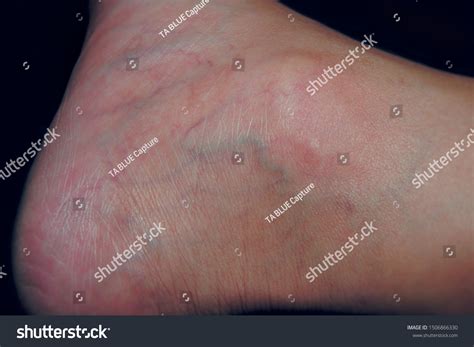 close  view ankle  skin stock photo  shutterstock