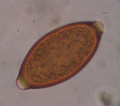 Roundworm Eggs In Humans