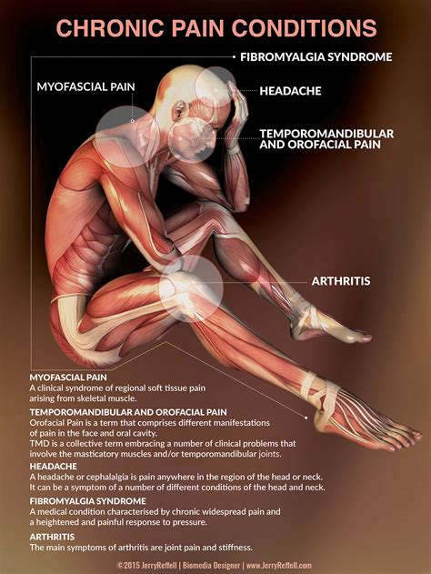 Chronic Pain Conditions :: Behance