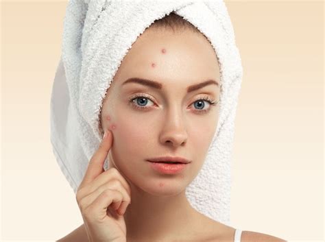 Here's why benzoyl peroxide is the best ingredient for acne-free skin