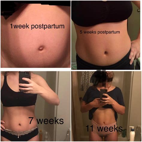 141 best r/postpartumprogress images on Pholder | Sometimes it’s about