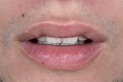 Multidisciplinary approach - Dental Inpuls