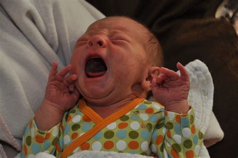 ankyloglossia | The Second 9 Months
