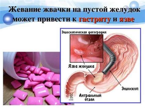 Можно ли утром тренироваться на голодный желудок – Можно ли утром ...