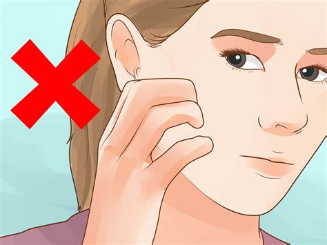 how to get rid of black spots on your face 5
