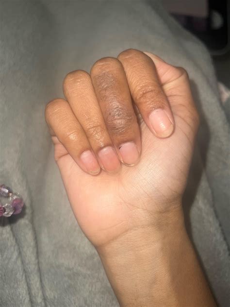 [Product Request] Any ideas on how to stop the itching? : r