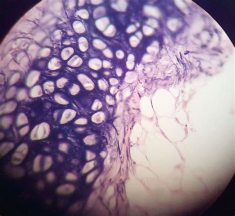 Duda's Epic Quest To Epicness: Epiglottis Histology