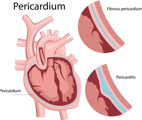 Perikardium: Struktur dan Fungsinya bagi Jantung - Hello Sehat