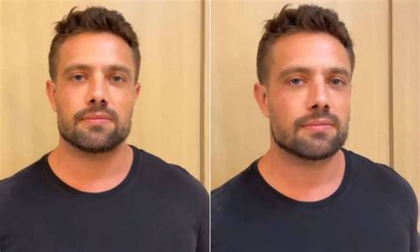 Rafael Cardoso reaparece após sumiço das redes e mostra harmonização | HZ