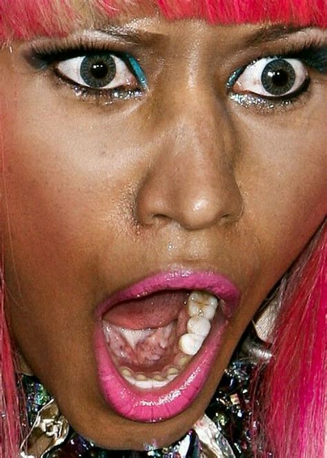 Nicki Minaj Fake Teeth