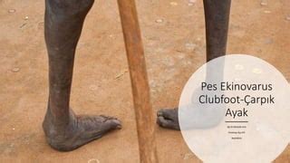 Pes Ekinovarus | PPT