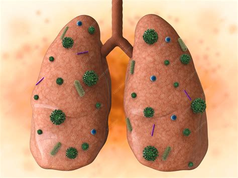 Bactéria No Pulmão Tem Cura - Renderização 3d de doenças pulmonares com células de bactérias | Foto ...