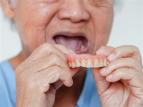 Não Consigo Comer Com A Prótese Dentária