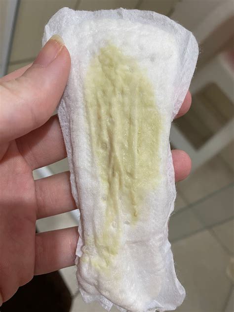 Corrimento Esverdeado Na Gravidez Prejudica O Bebê - Corrimento amarelo esverdeado | BabyCenter