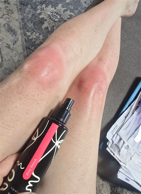 Jennifer Lynn - That's enough sun for today 🙈 Finally get sun, my knees