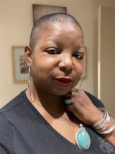 This Woman's Face Ballooned And She Had To Shave Her Head After An