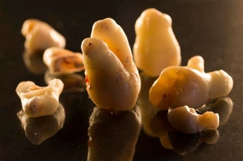 premium photo close   broken teeth