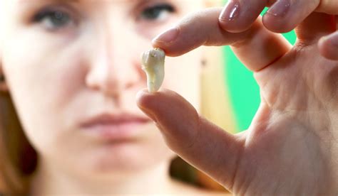 5 Proven Ways To Heal Your Extraction Site Like A Pro