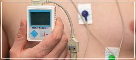 holter monitoring    downey ca call