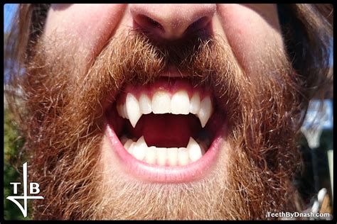 Wolf - Teeth By Dnash