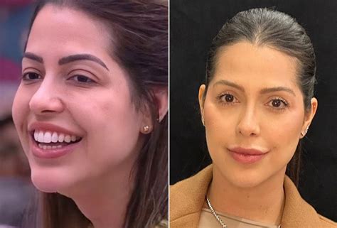 Lais Caldas Antes E Depois - Laís Caldas faz manutenção de correção de pálpebras; veja antes e ...