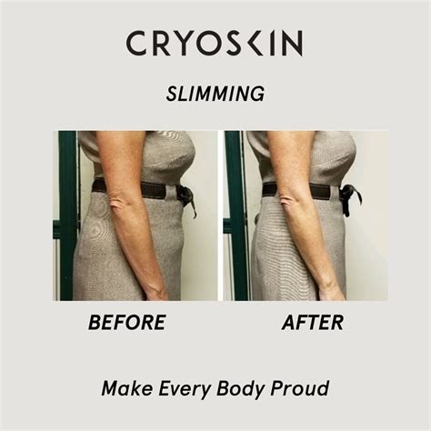 Cryoskin - Fat Loss Device - Facial Treatment - Near Me