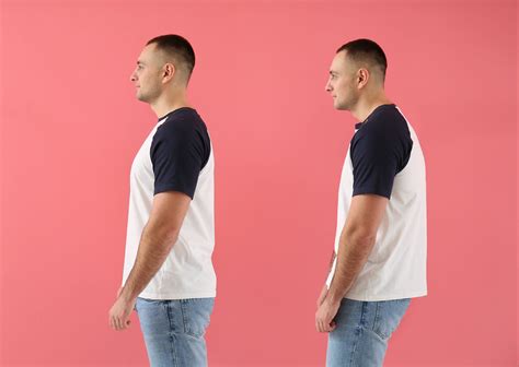 What Is Good Posture + Why It's Important | Fargo Spine